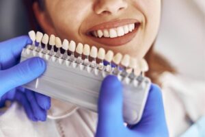 porcelain veneers in Blackfalds