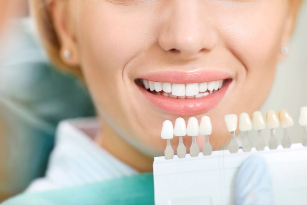 Yellow Teeth Causes and How to Whiten Teeth