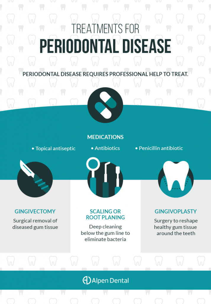 Treatments For Periodontal Disease