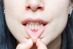 does gum recession grow back