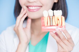 lifespan of dental implants