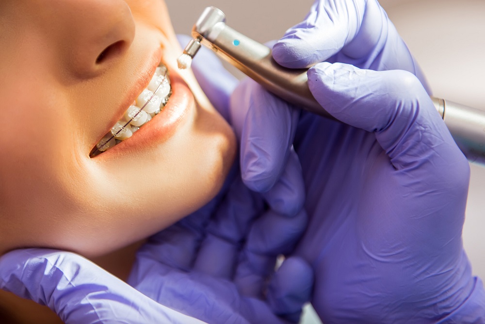 signs-that-you-can-no-longer-avoid-visiting-an-orthodontist