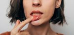 what is gum recession and can it be treated without surgery near red deer